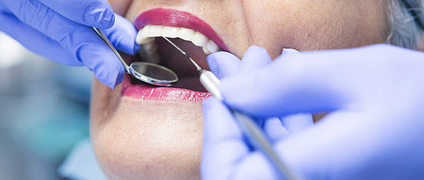 Best Emergency Treatment for Oral Infections in East Patchogue, NY